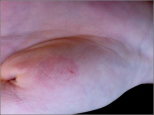 peau-seche-des-mains-1