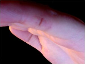 peau-seche-des-mains-2