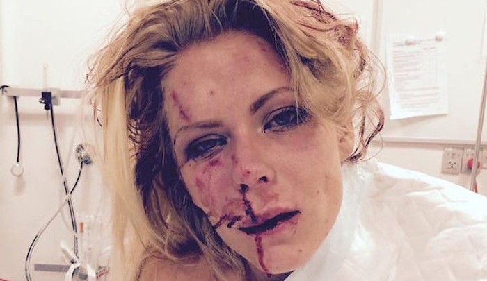 Nanna Skovmand, une femme danoise battue par des musulmans venus de Somalie.