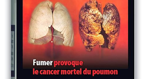 fumer-provoque-le-cancer-mortel-du-poumon